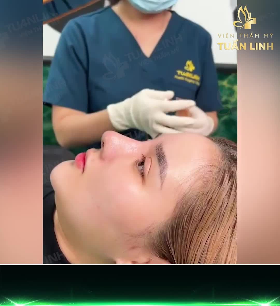 NÂNG MŨI TÁI CẤU TRÚC ( MŨI SỬA LẠI ) CÓ LÊN DÁNG ĐẸP ĐƯỢC THEO ĐÚNG MONG MUỐN KHÔNG??